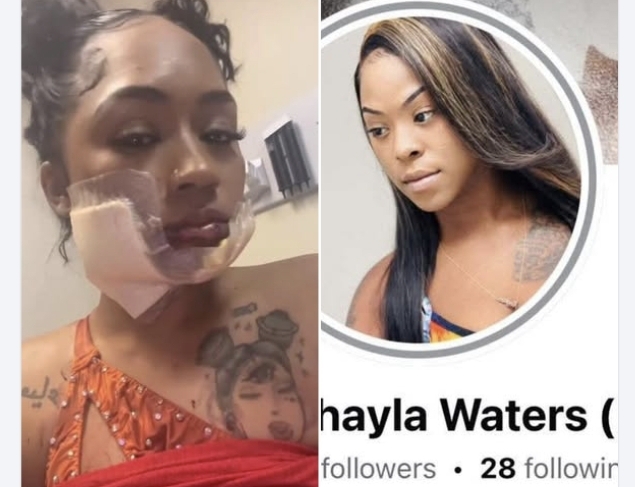 Mother of Two Injured in Violent Attack After Offering Safety Tip at Club